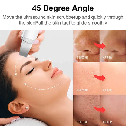 45 degree angle electric face scrubber , move the ultrasound skin scrubber up and quickly throuh the skin pull the skin taut to glide smoothly